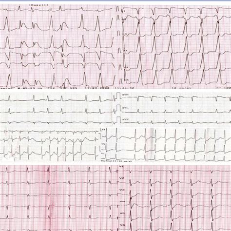 busty mandy ecg|Quick Facts:Electrocardiography .